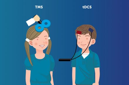 مقایسه ی TMS و tDCS